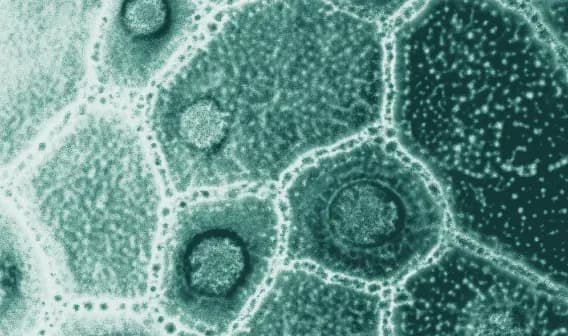 blog_Tout savoir sur les prébiotiques, probiotiques et postbiotiques _ bienfaits et sources naturelles