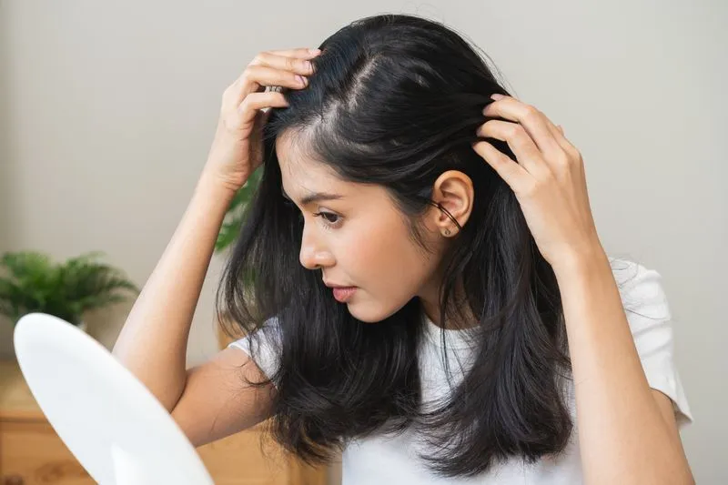 Cheveux cassants chute